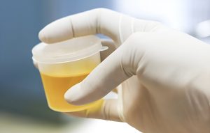 Does Synthetic Urine Expire?